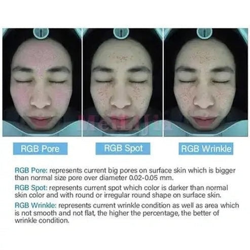 3D Smart Magic Mirror Facial Analysis Skin Care